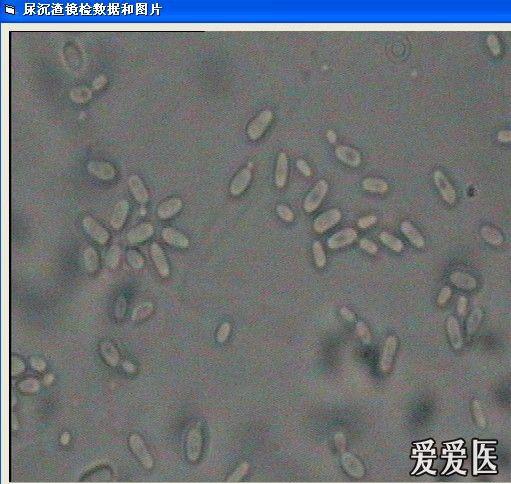 尿沉渣镜下图