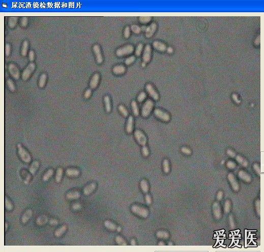 尿沉渣镜下图