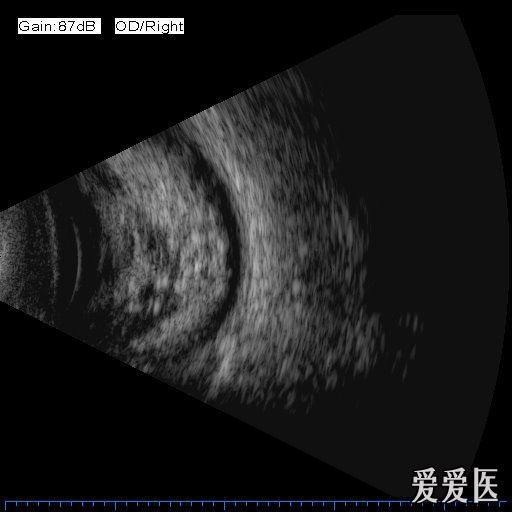 请大家看看这个b超