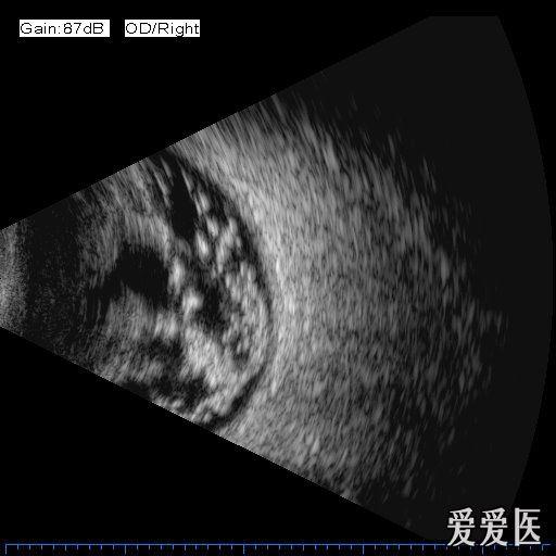 请大家看看这个b超
