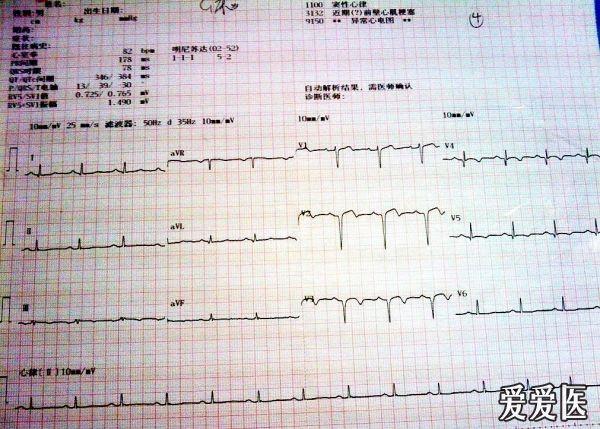 请教一份疑难心电图求正解!