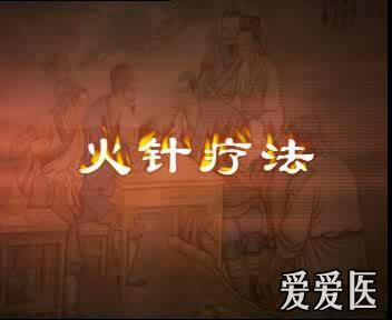 无痛针灸毫火针