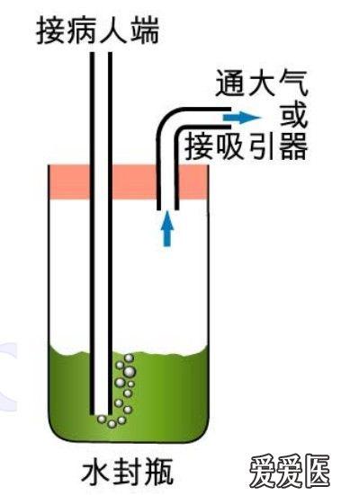 呼吸版经验交流(1 )胸腔引流:常见问题解答(共22个问题)