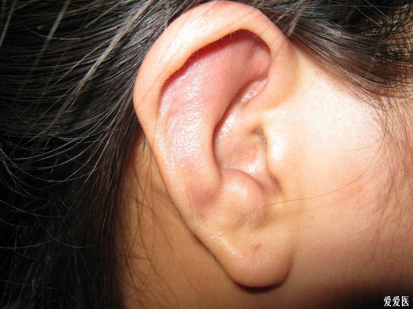85.耳廓软骨（前面观）-基础医学-医学