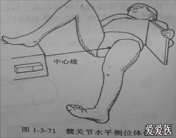放射投照髋关节有轴位这么个投照方位吗?