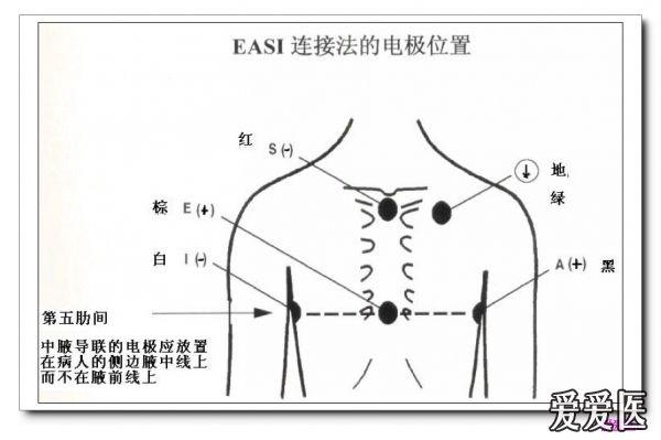 山羊老师课程常见心电图诊断知识讲座第二十八讲 有关动态心电图