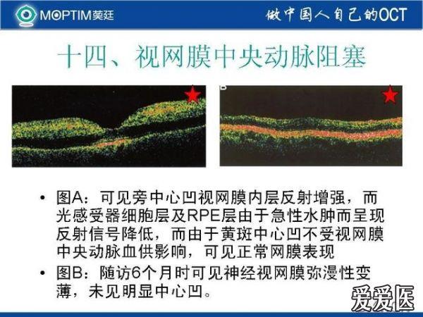 我收集的oct图