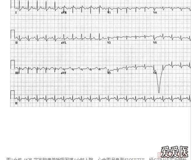 急性胸痛的心电图诊断思路