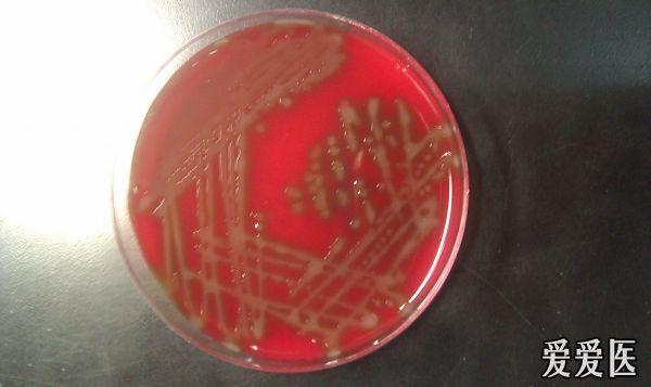 麦康凯平板阴性,血平板 粘液型菌落,血平板可见草绿色溶血环