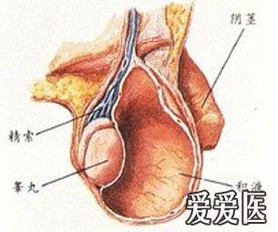 教你识病8"睾丸鞘膜积液"