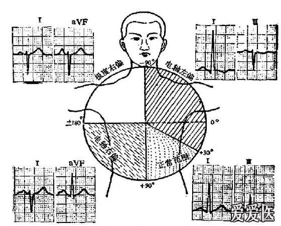 看图学心电02心电轴测量