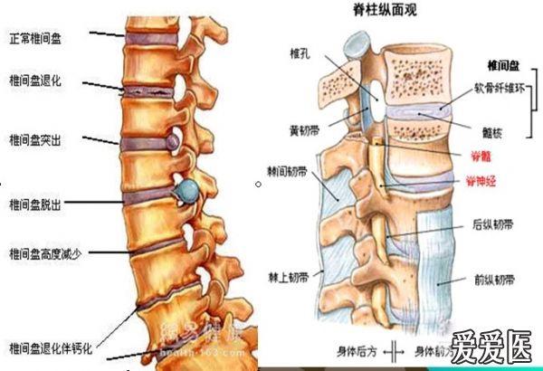 [讲座]腰椎间盘突出的病理及影像诊断