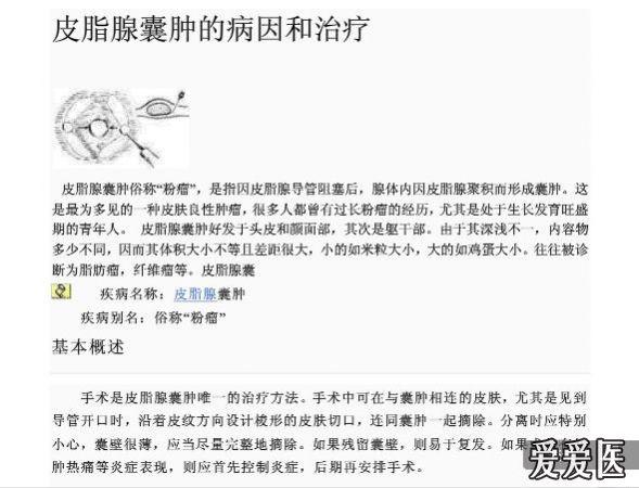 皮脂腺囊肿(体表图,超声图,手术标本)