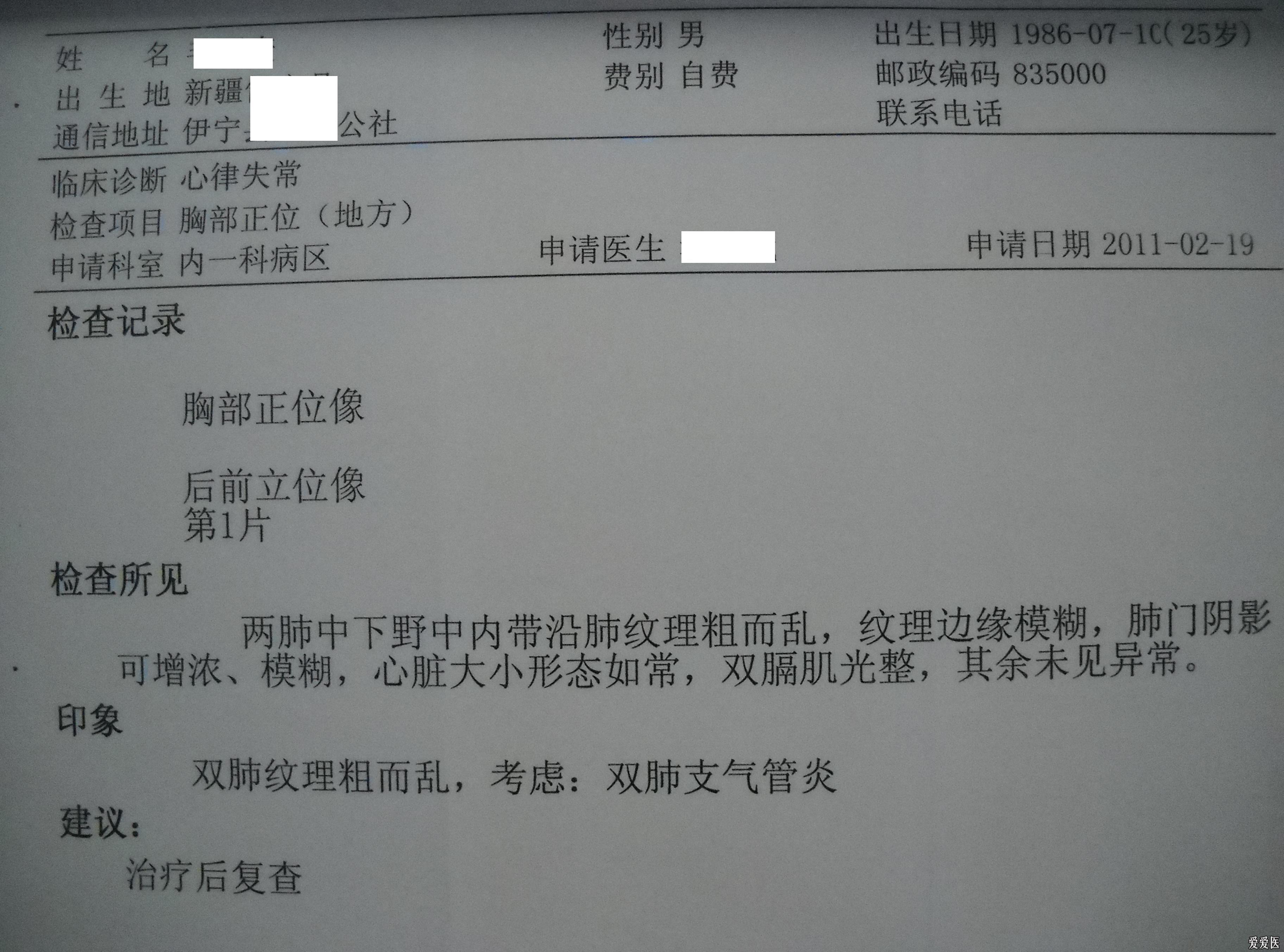 反复胸闷,心悸1年余,加重4 h,伴咯血1次