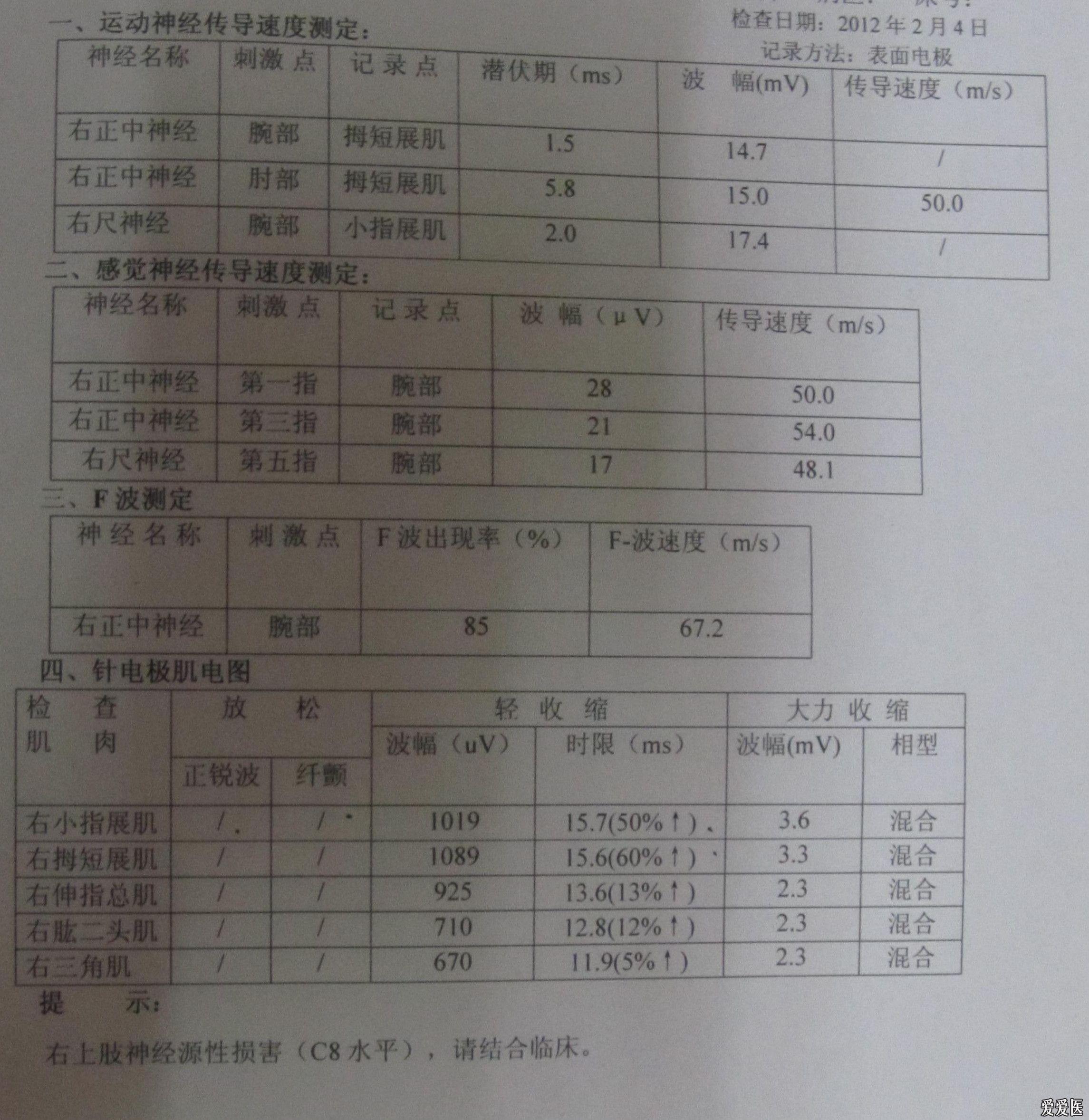 一份肌电图报告,多种解读