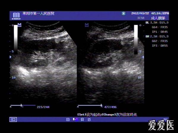 肾错构瘤 - 超声医学讨论版 - 爱爱医医学论坛 - 爱爱