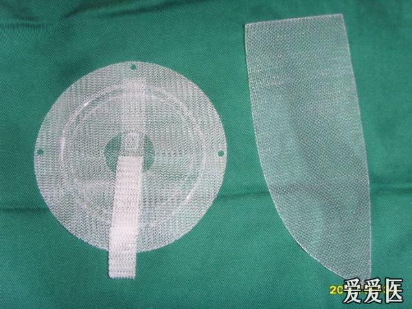 腹股沟无张力疝修补术(各型补片类型)