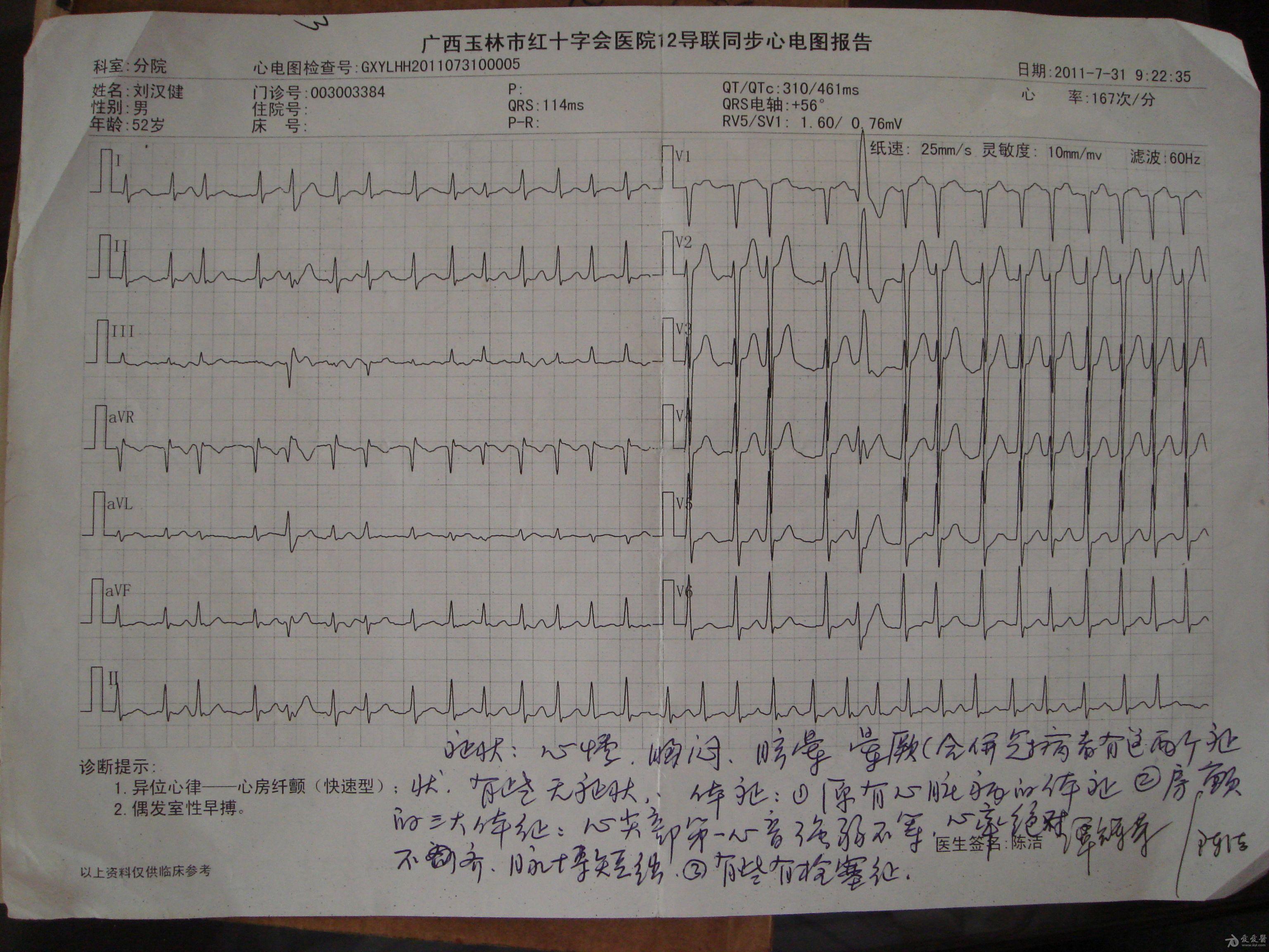 心律不齐,第一心音强弱不等,各听诊区未闻及杂音,脉搏短绌,肺呼吸音