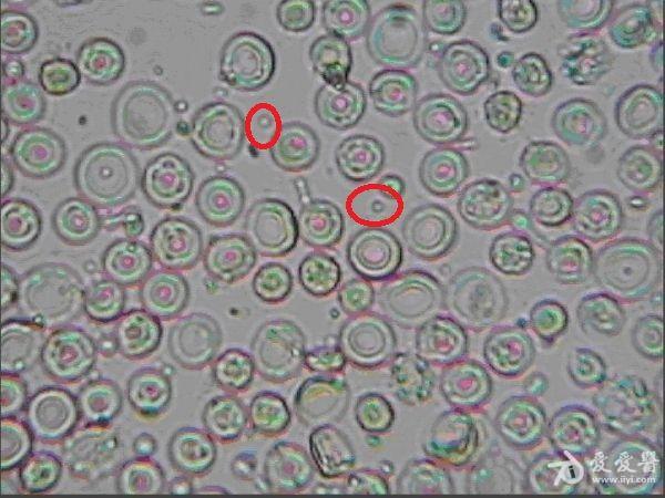 尿中异常红细胞,请大家讨论 - 检验医学讨论版 - 爱爱