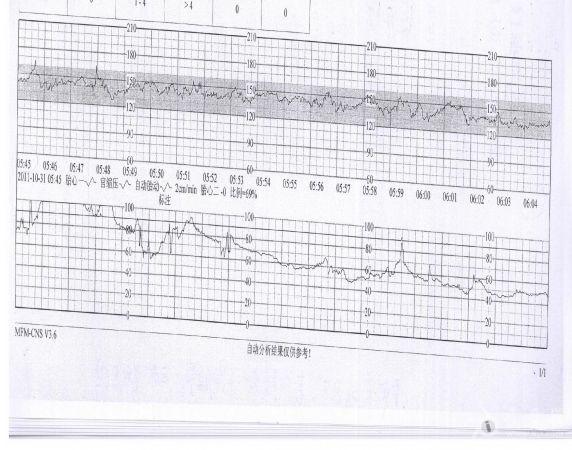 帮忙看一张胎心监护图