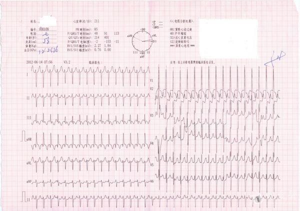 病例分析心率200次/分