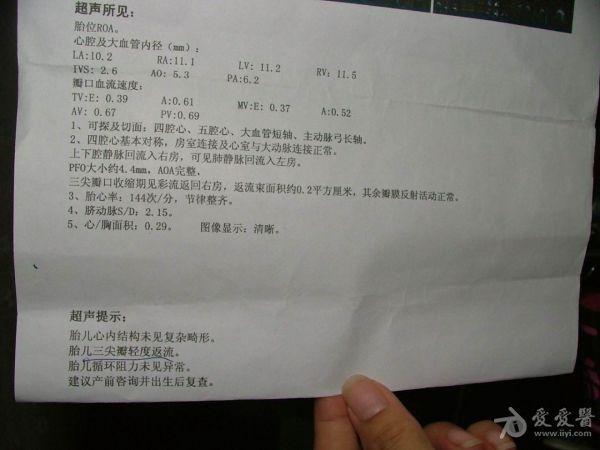 双源ct与超声心动图评估左心功能的比较研究