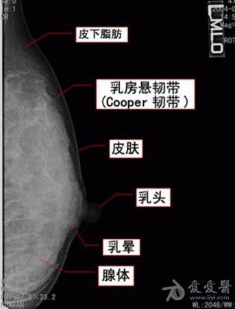 乳腺癌的x线诊断.ppt[钼钯 x光]