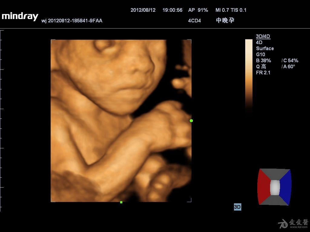 胎儿四维图片欣赏