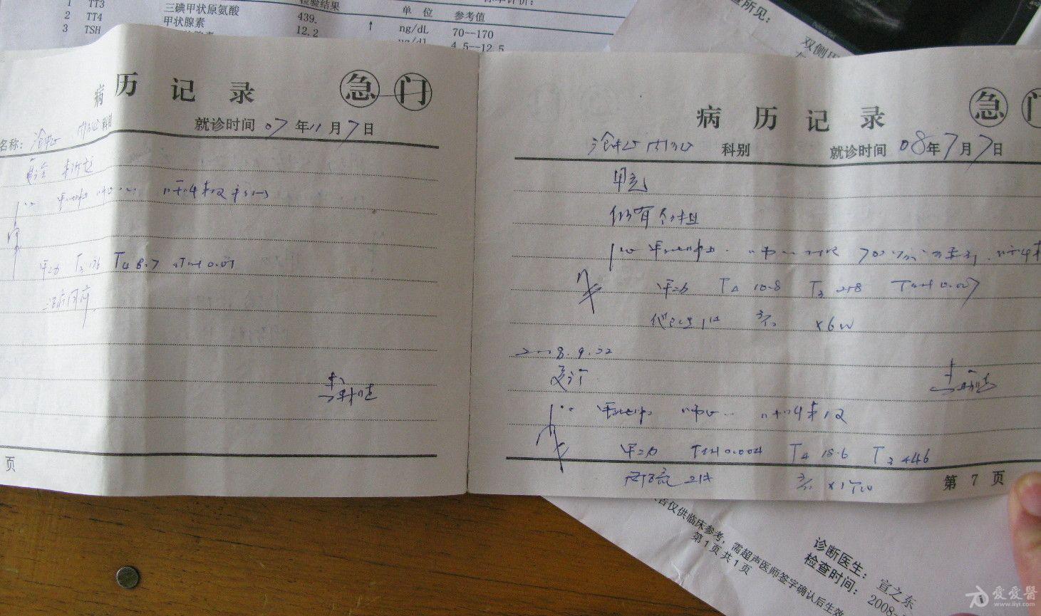 穴位埋线法治疗甲亢的视频
