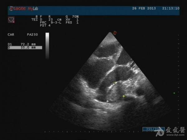 还是其它?有视频 超声医学讨论版 爱爱医医学论坛 爱爱医医学网