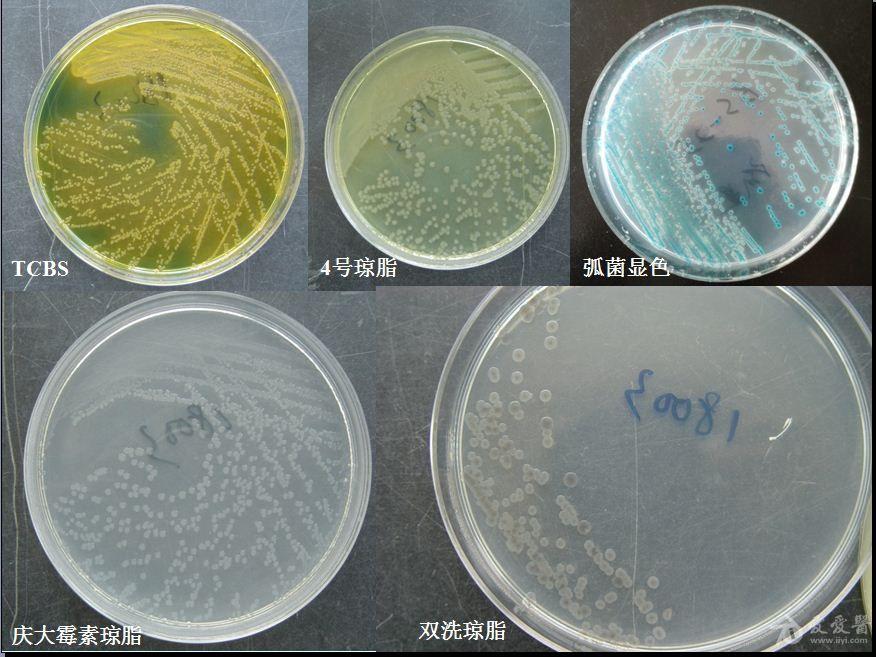 霍乱弧菌菌落形态图片及检测流程