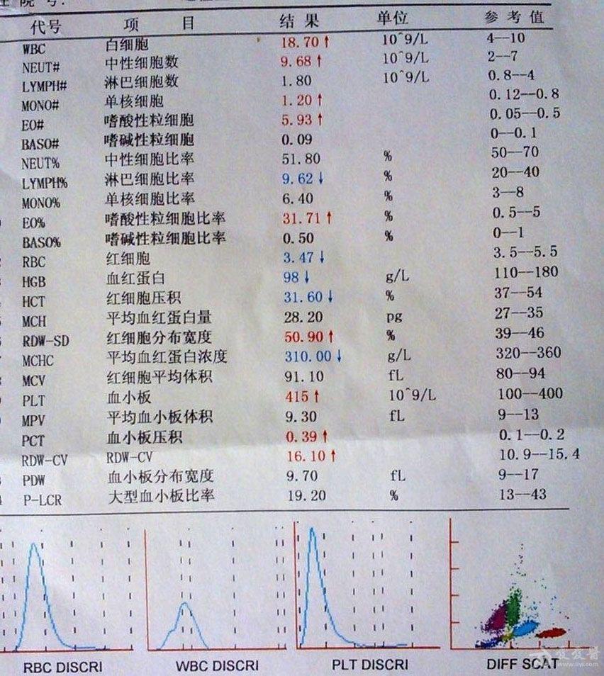 消瘦,乏力伴发热,血常规示嗜酸性粒细胞增多