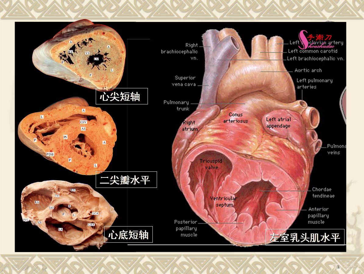超声心动图基础切面打法图解(初学者可参考)