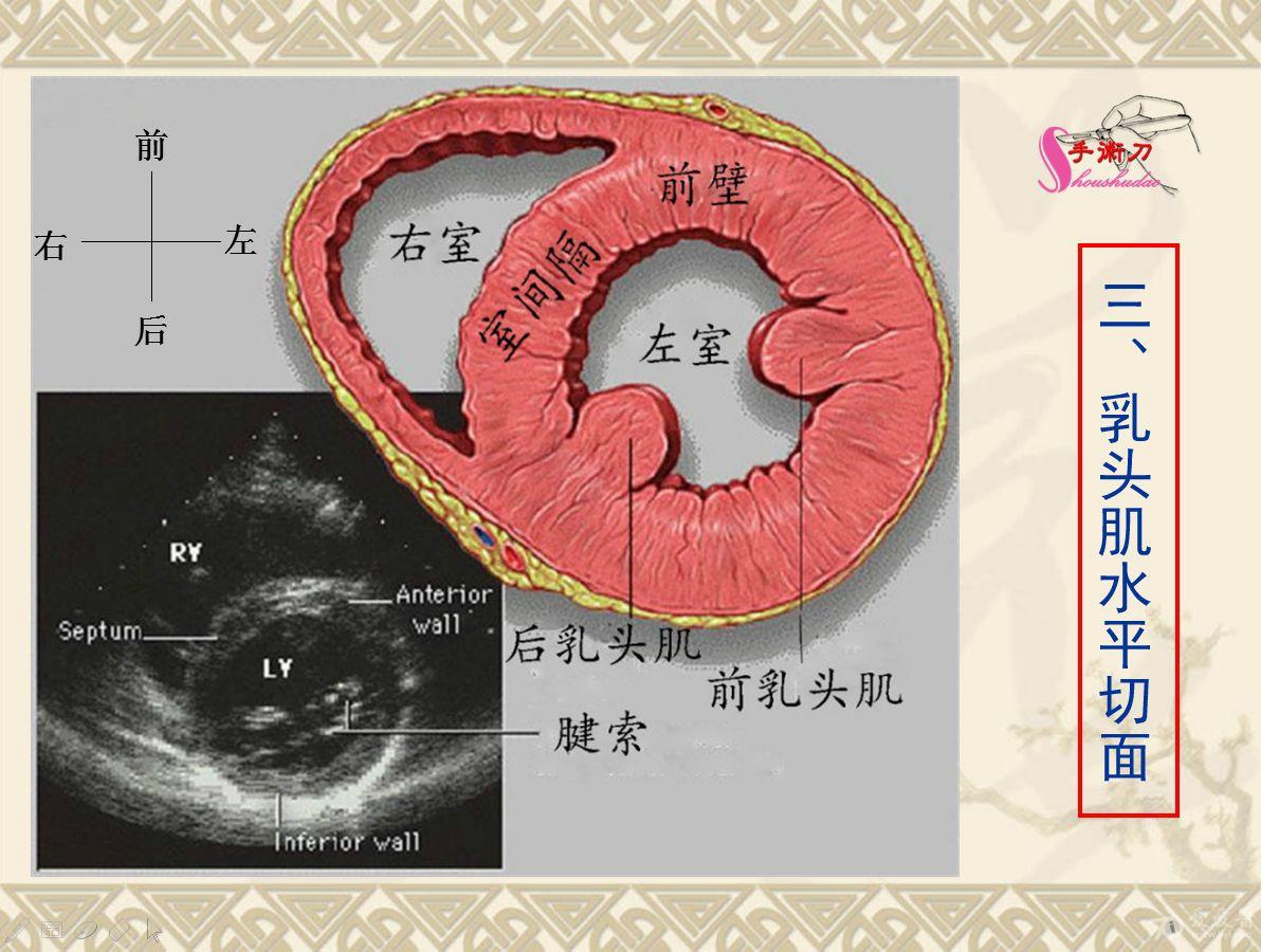 超声心动图基础切面打法图解(初学者可参考)