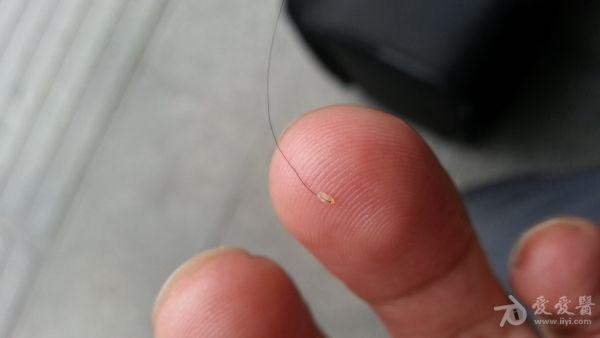 <em>头发根部</em>有类似脂肪小颗粒