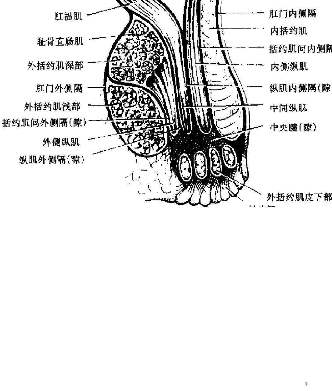 判断为高位复杂性肛瘘,结合了张东铭的《大肠肛门局部解剖与手术学》