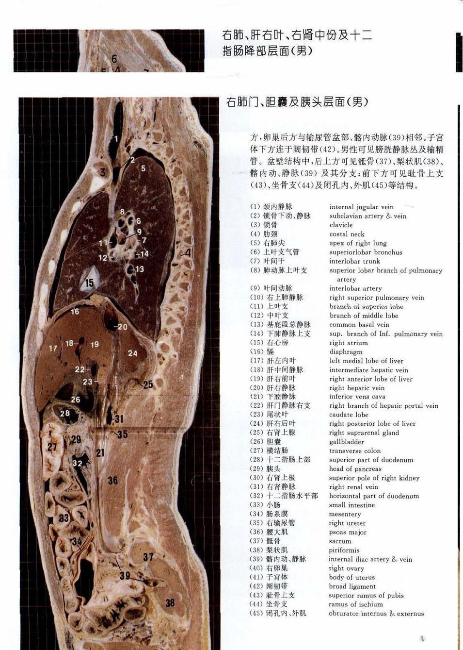 发几张不多见的腰背肌尸体解剖图片,矢状面