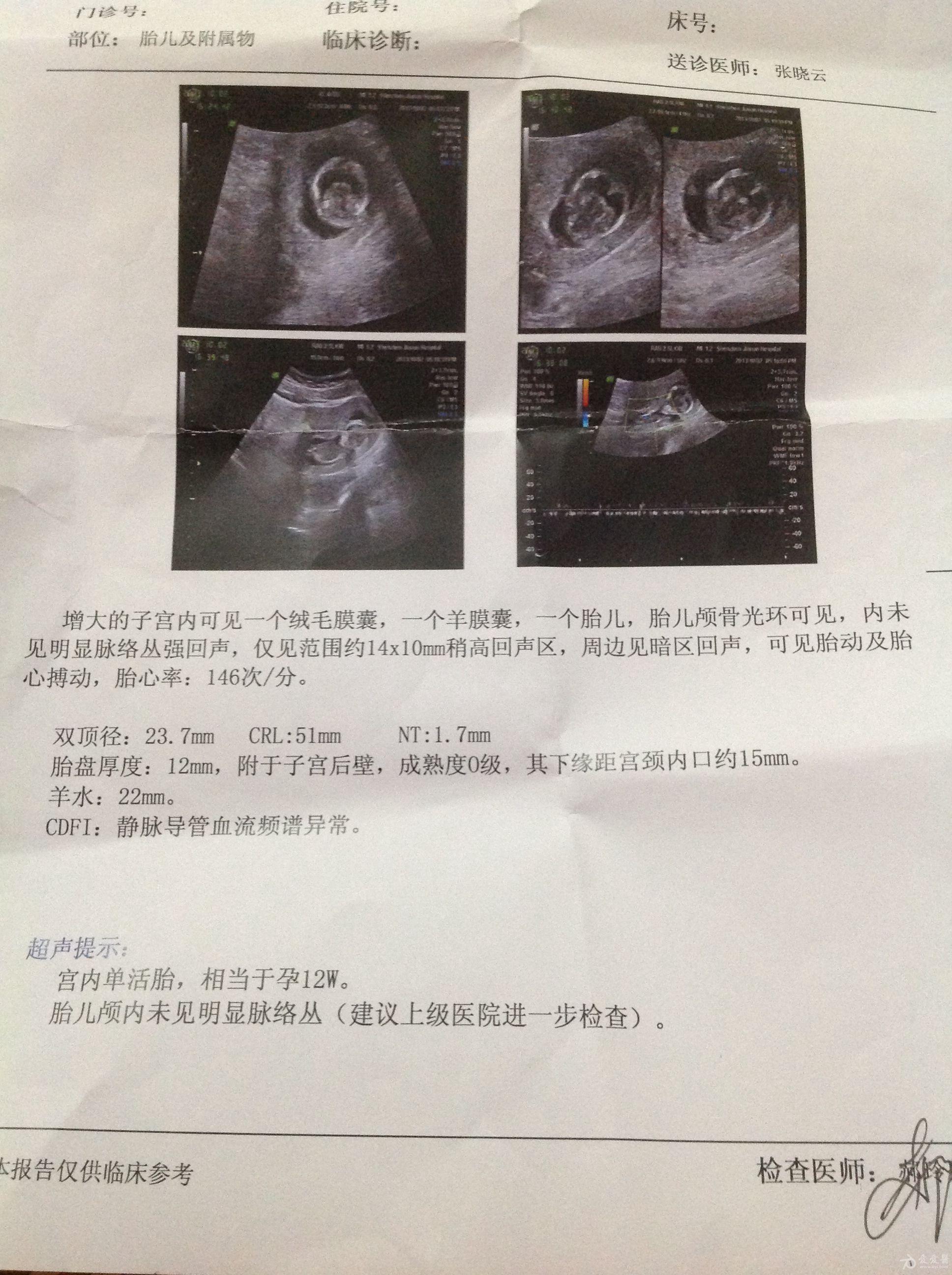 孕七个多月做b超,问医生胎儿的性别,刚开始医生笑笑不