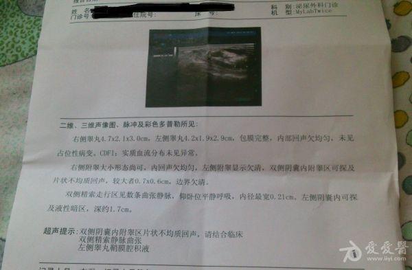 同一家医院做两次阴囊彩超结果相差很大,求帮助!