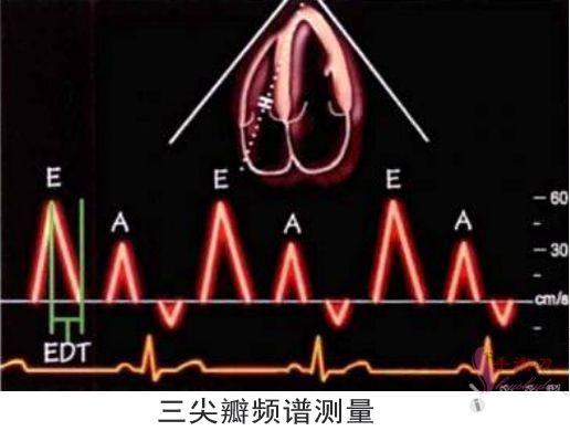 图解二维超声心动图正常值与测量