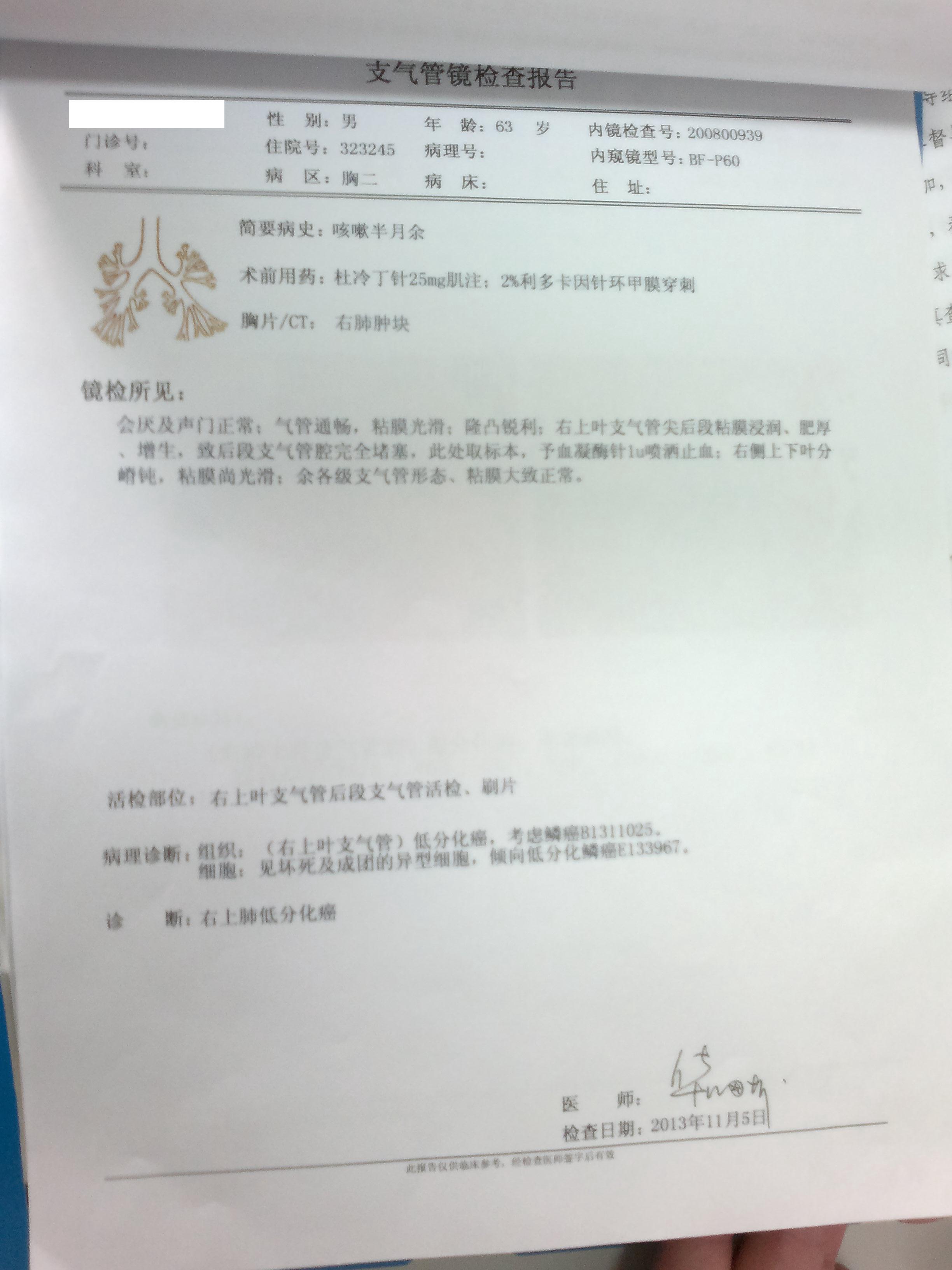 肺癌鳞癌的求助