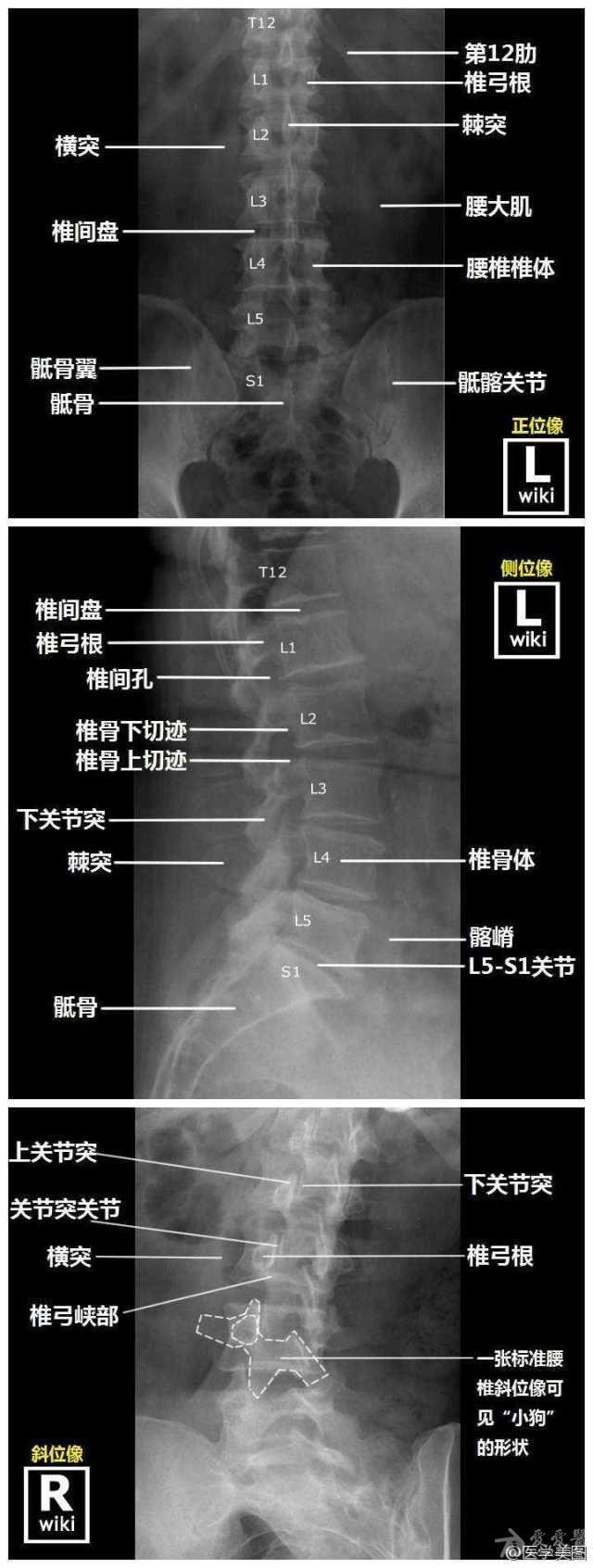 狗脖子解剖图标注-转