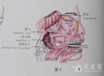 骨扩大切除术【适应症 上颌窦恶性肿瘤,累及眶内,颞下窝,翼腭窝,并