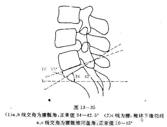 10楼回复缔造者   腰骶角系由l5下终板与s1上终板所成的夹角,正常值