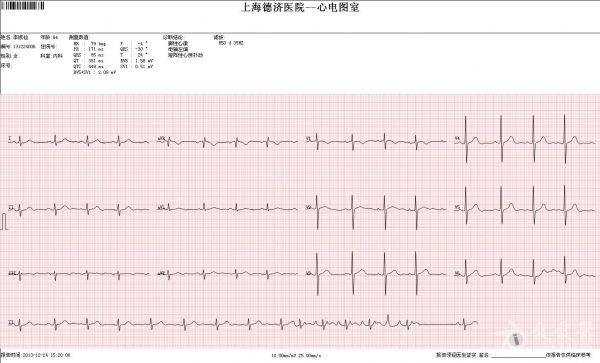 84y原有af 12导同步心电图不能上传 谅解