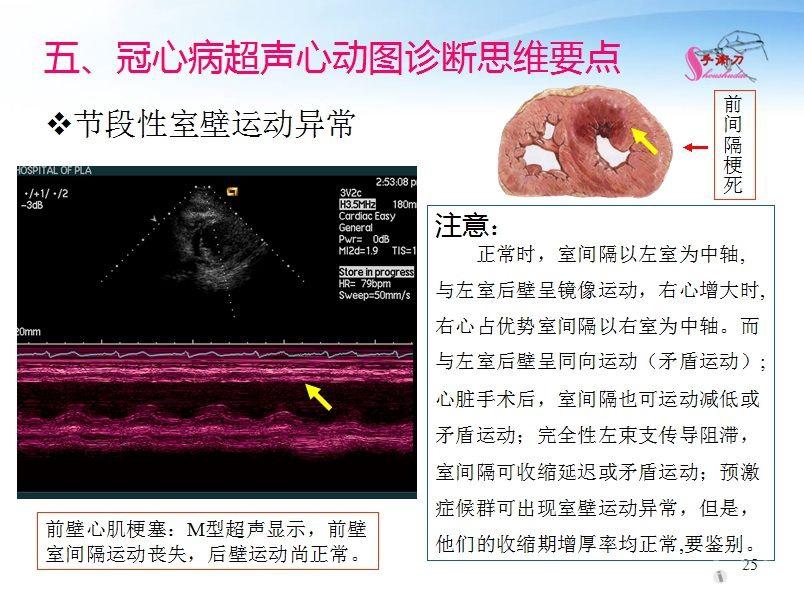 冠心病的超声诊断思维要点