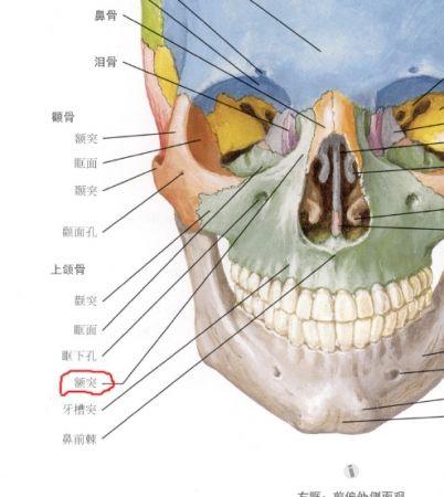 上颌骨额突骨折,搞清楚什么叫鼻颌缝,就不会有太多的争议啦,解剖位置