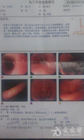 食道,十二指肠粘膜隆起,判断性质