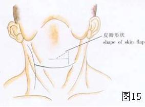 267例老年耳鼻咽喉患者合并基础疾病在围手术期治疗的临床分析