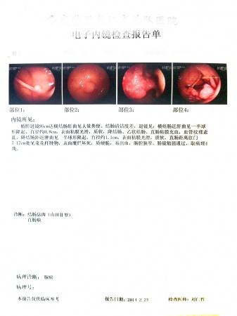 直肠癌术后20天病理是否严重